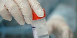 biopsia bari