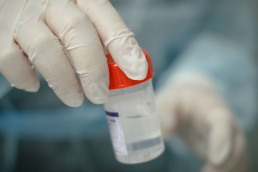 biopsia bari