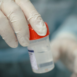 Biopsia dei tessuti del cavo orale bari