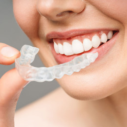 Ortodonzia trasparente Invisalign bari